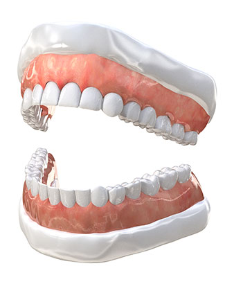 Complete and partial dental dentures are done by Dr. Patrick Spilotro, dentist in Vernon Hills IL, at his 60061 office. Come in today and learn more about dental dentures in Vernon Hills IL. Dentures in Vernon Hills IL